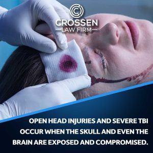 open head injury