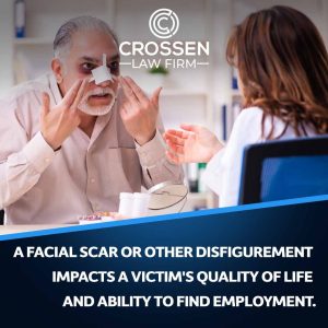 disfigurement attorney
