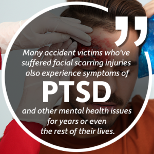 ptsd