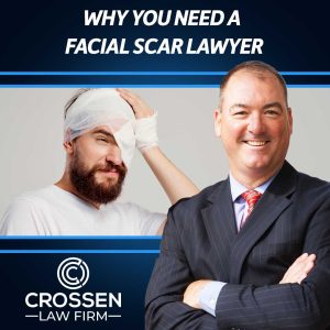 why you need a lawyer