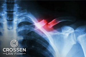 Personal Injury Attorney in Richmond, Indiana