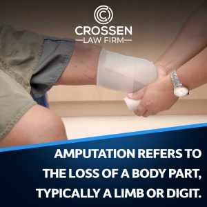 crossen amputation refers to