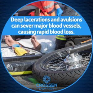 lacerations and avulsions